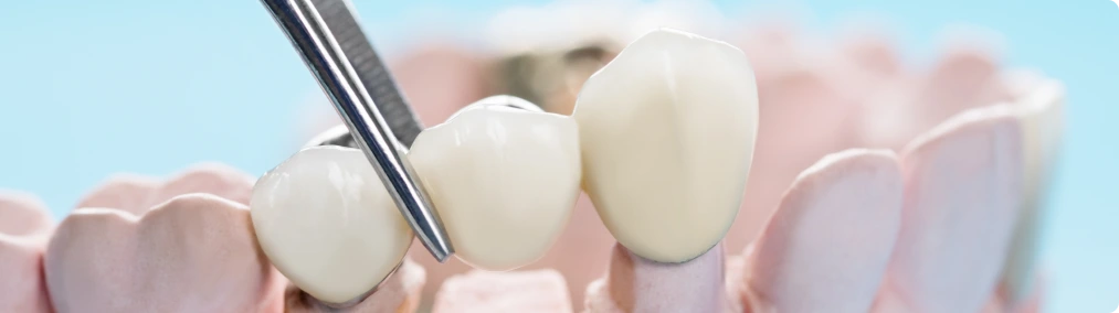 Dentratec Developed a groundbreaking dental