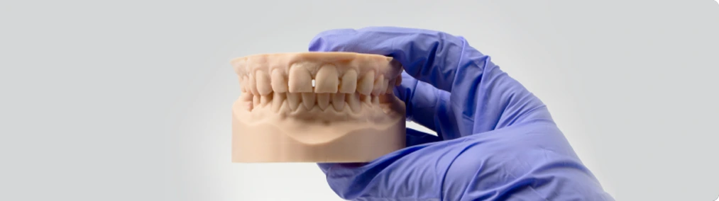 Dentratec Revolutionized chairside dentistry with rapid printing and accurate results 1